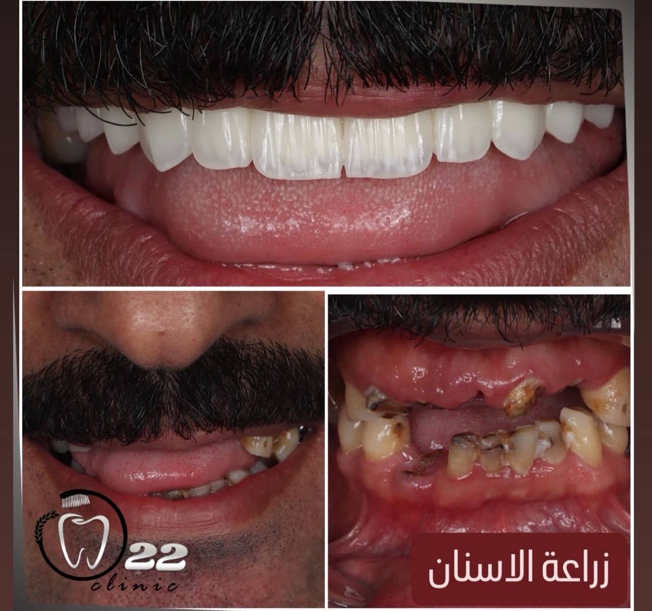 عمل 2
