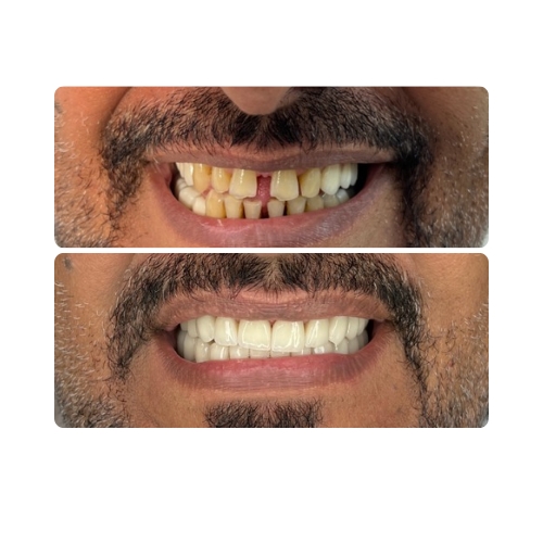 عمل 5